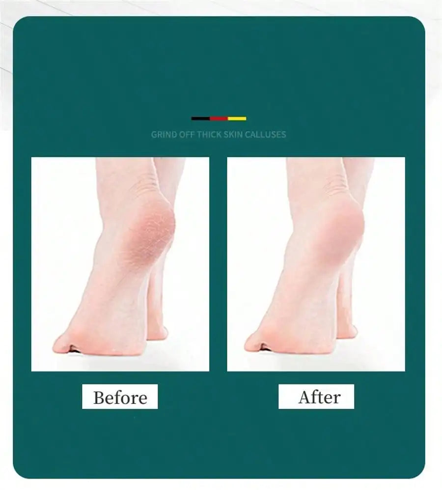 High Quality Foot File Double Sided Callus Remover For Dead Skin Professional Pedicure Tools Callous Scraper Sander Heel Filer